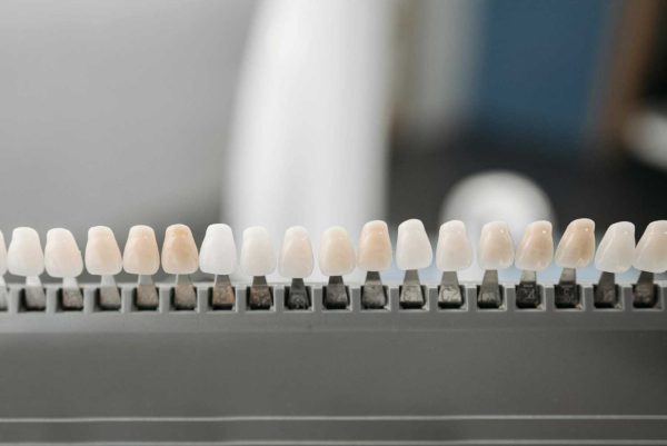 Read more about the article Zubna protetika: Kompletan vodič za dentalnu protetiku