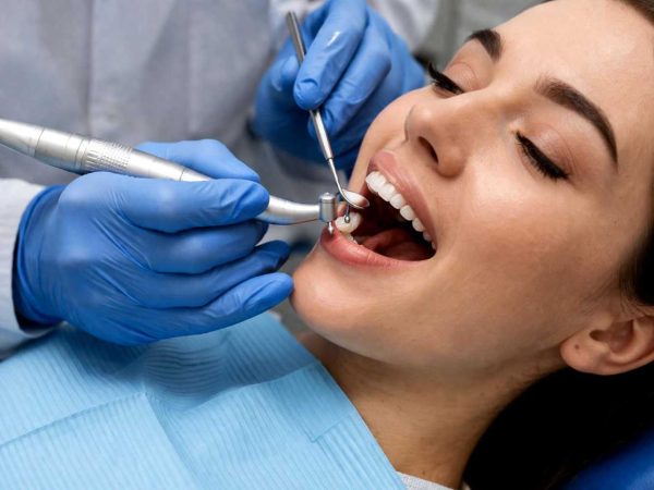 Plombiranje zuba: Kompletan vodič za pacijente