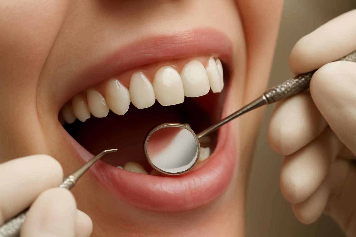 parodontopatija lečenje