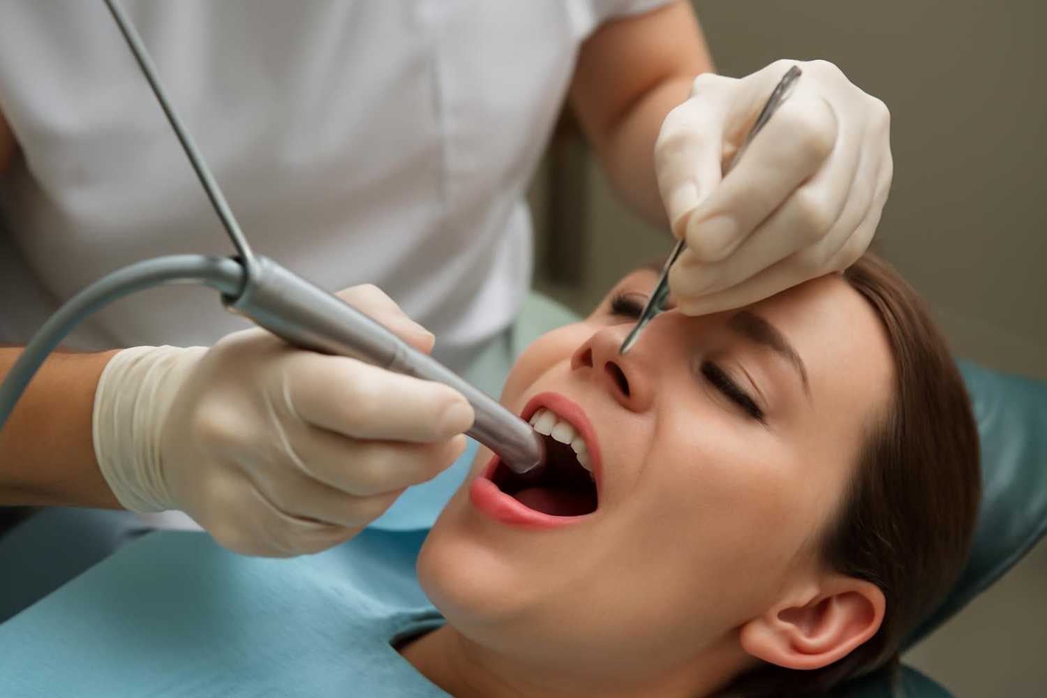 vađenje živca iz zuba