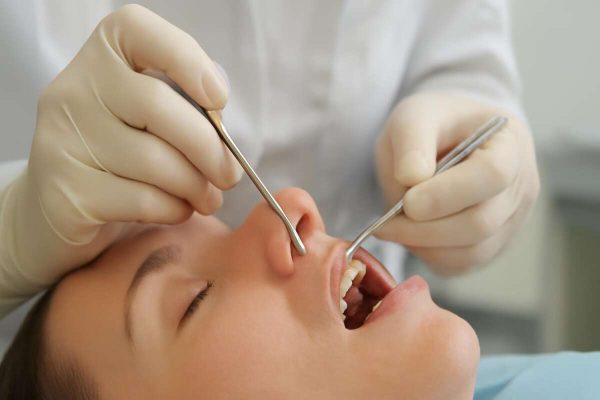 Krestalni sinus lift za implantate: Vodič za pacijente