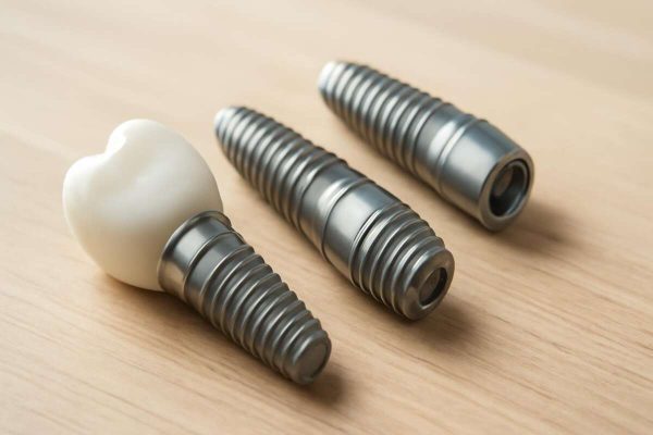 cena zubnih implantata