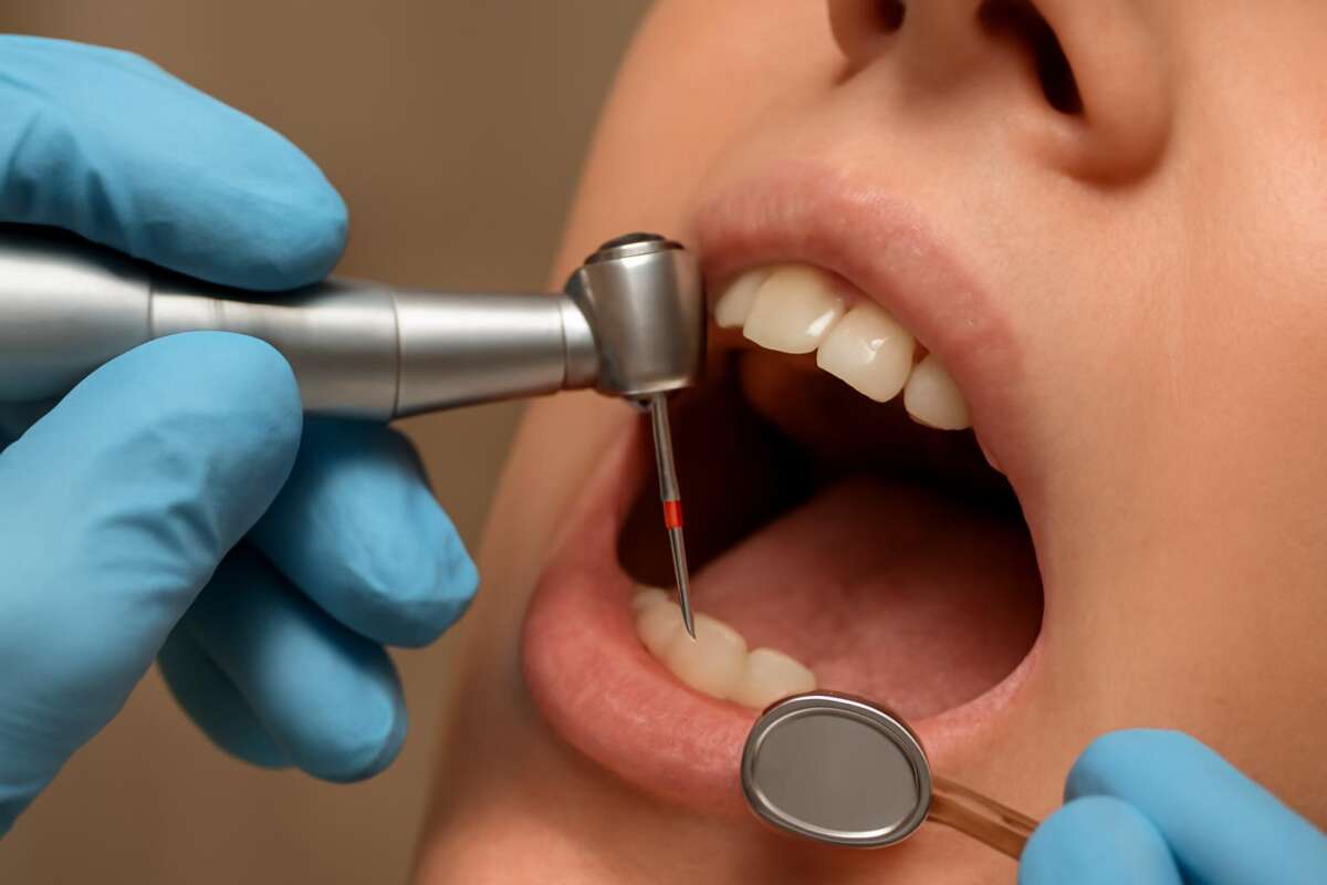 mašinska endodoncija